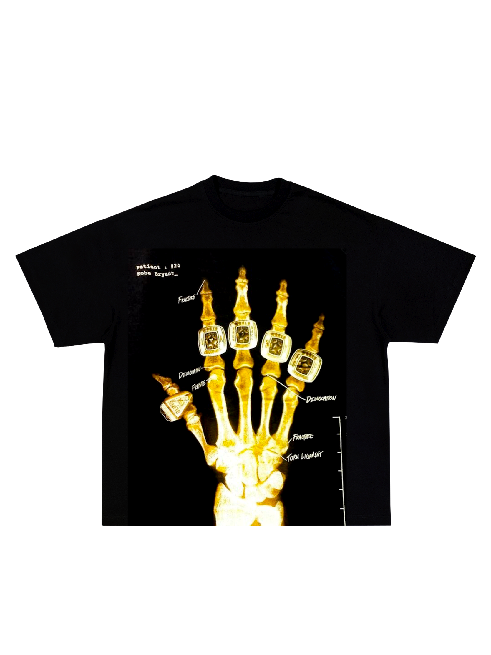 kobe x ray t shirt